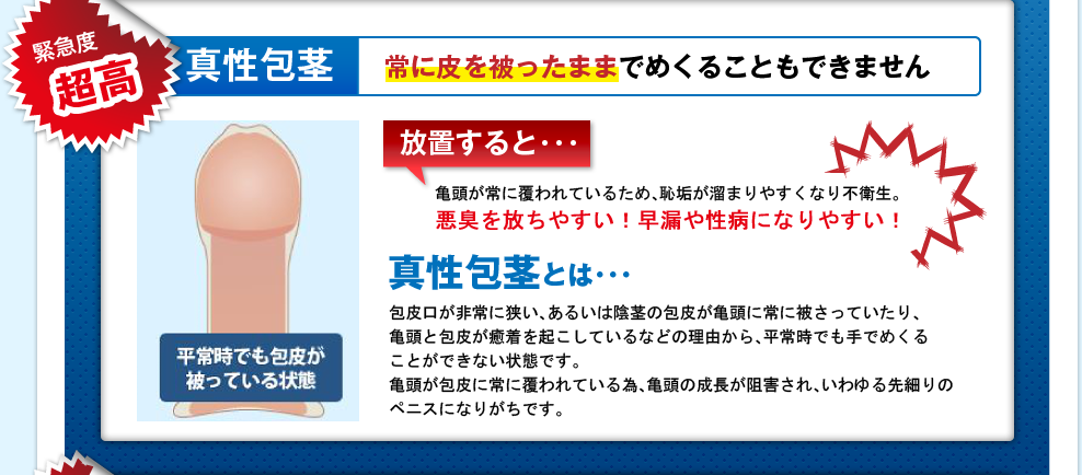 緊急度超高 真性包茎 常に皮を被ったままでめくることもできません