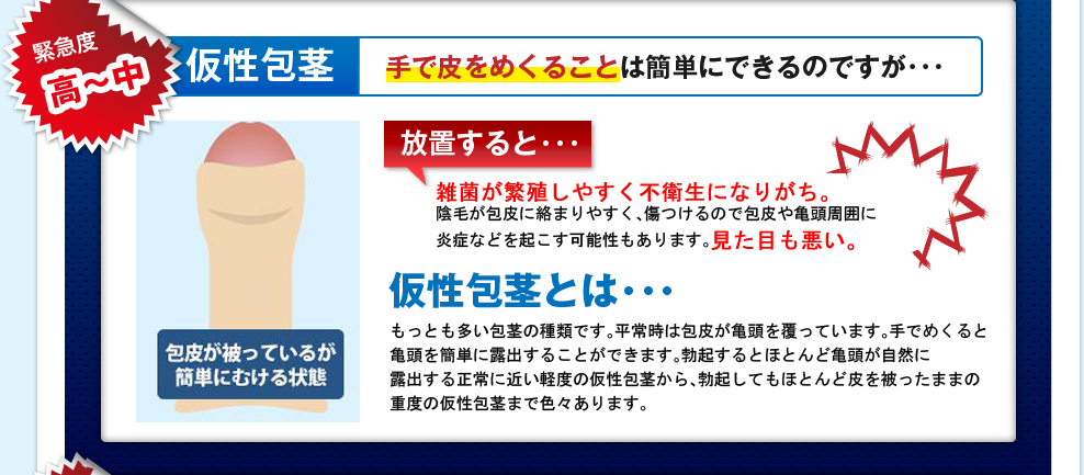 緊急度高～中 仮性包茎 手で皮をめくることは簡単にできるのですが･･･