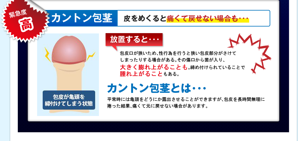 緊急度高 カントン包茎 皮をめくると痛くて戻せない場合も･･･